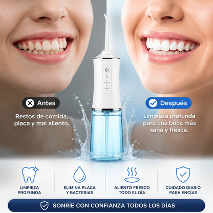 OralClean™ | Irrigador Bucal Eléctrico para una Limpieza Profunda Todos los Días
