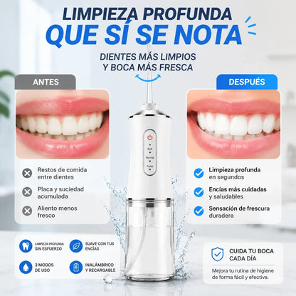 OralClean™ | Irrigador Bucal Eléctrico para una Limpieza Profunda Todos los Días